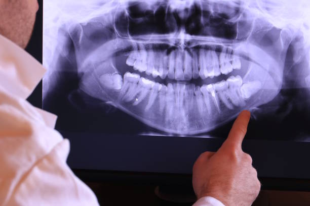 Best Emergency Wisdom Tooth Extraction in Lechee, AZ