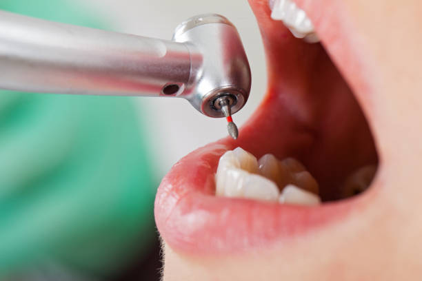Best Emergency Dental Care for Sports Injuries in Lechee, AZ